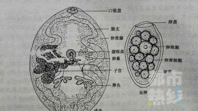 陕西12岁女孩患上结核病西安医生确诊肺吸虫病原来她常喝山间溪水